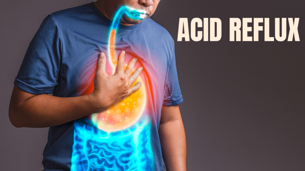 Acid Reflux (Heartburn): Causes | Risk factors | Symptoms | Lifestyle changes