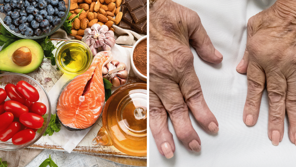 Anti-Inflammatory Diet for Rheumatoid Arthritis: What to Eat and Avoid
