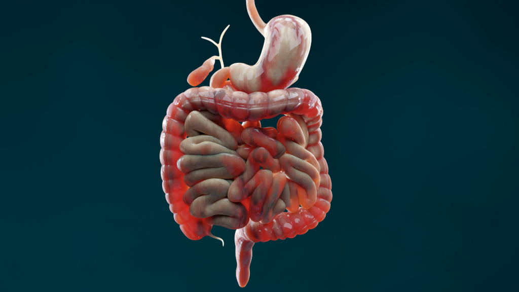 Crohn’s Disease Diet and Lifestyle Guide: Foods to Eat, Foods to Avoid, and Daily Management