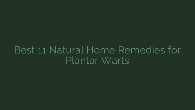 Best 11 Natural Home Remedies for Plantar Warts